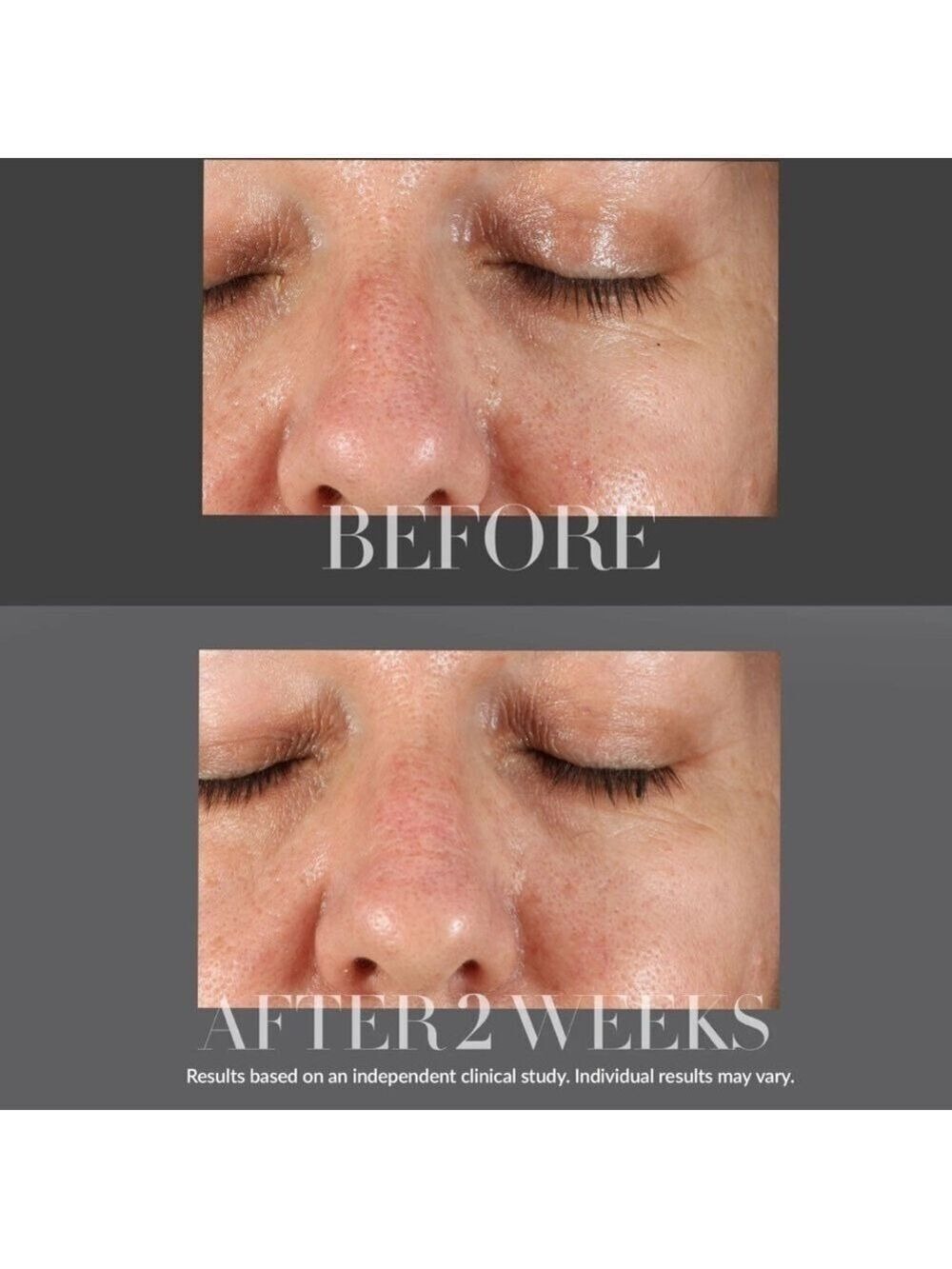 KATE SOMERVILLE KateCeuticals Resurfacing Peel Glycolic Retinol exfoliator - Picture 5 of 12